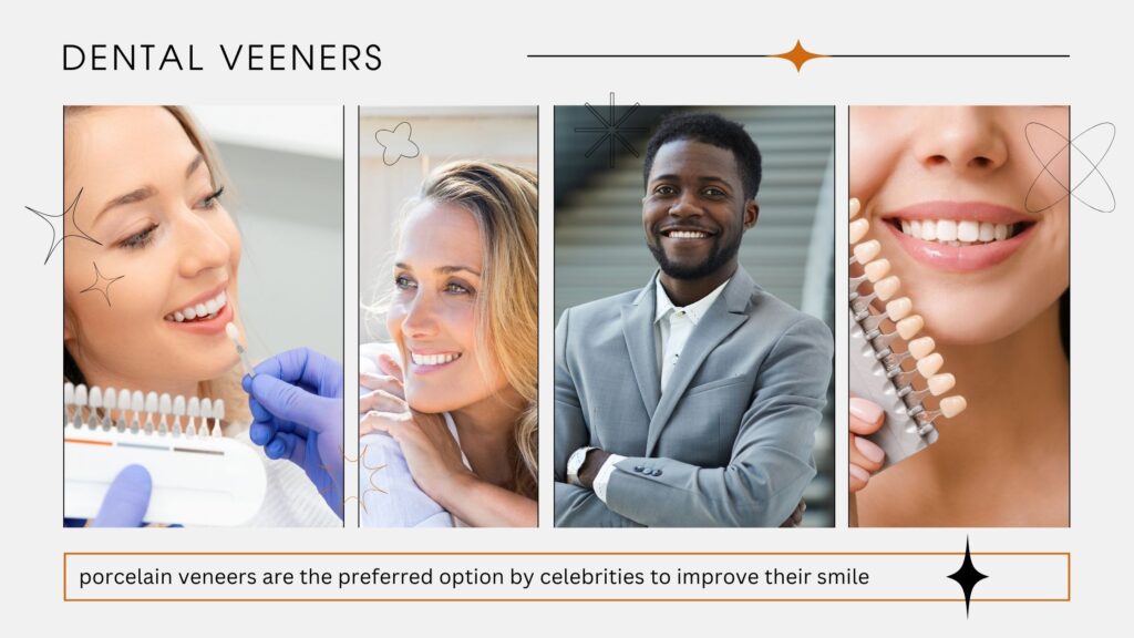 dental veneers preferred celebrity treatment for improving smile